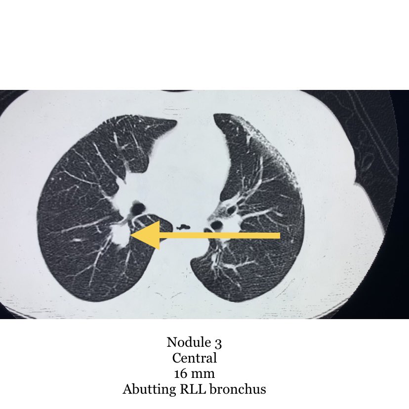 Endovascular Rounds tweet media
