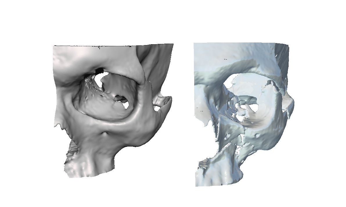 FabLab 3D Hospital Marañón tweet media