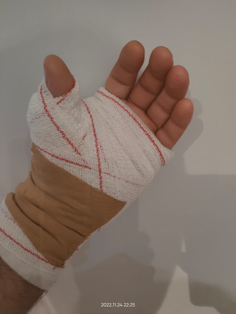 tu_abandono's tweet photo. 🛑🛑 #ULTIMAHORA | Otra AGRESIÓN a un Funcionario de Prisiones en España 🇪🇸 esta vez, en el C.P de Huelva

👉🏼 Funcionario apuñalado 🔪 en la mano al evitar que un interno peligroso MATASE a otro

Sin ser Agente de Autoridad, Ntras VIDAS están en #BlackFriday, gracias a @IIPPGob‼️ https://t.co/Y8xNvm0xgH