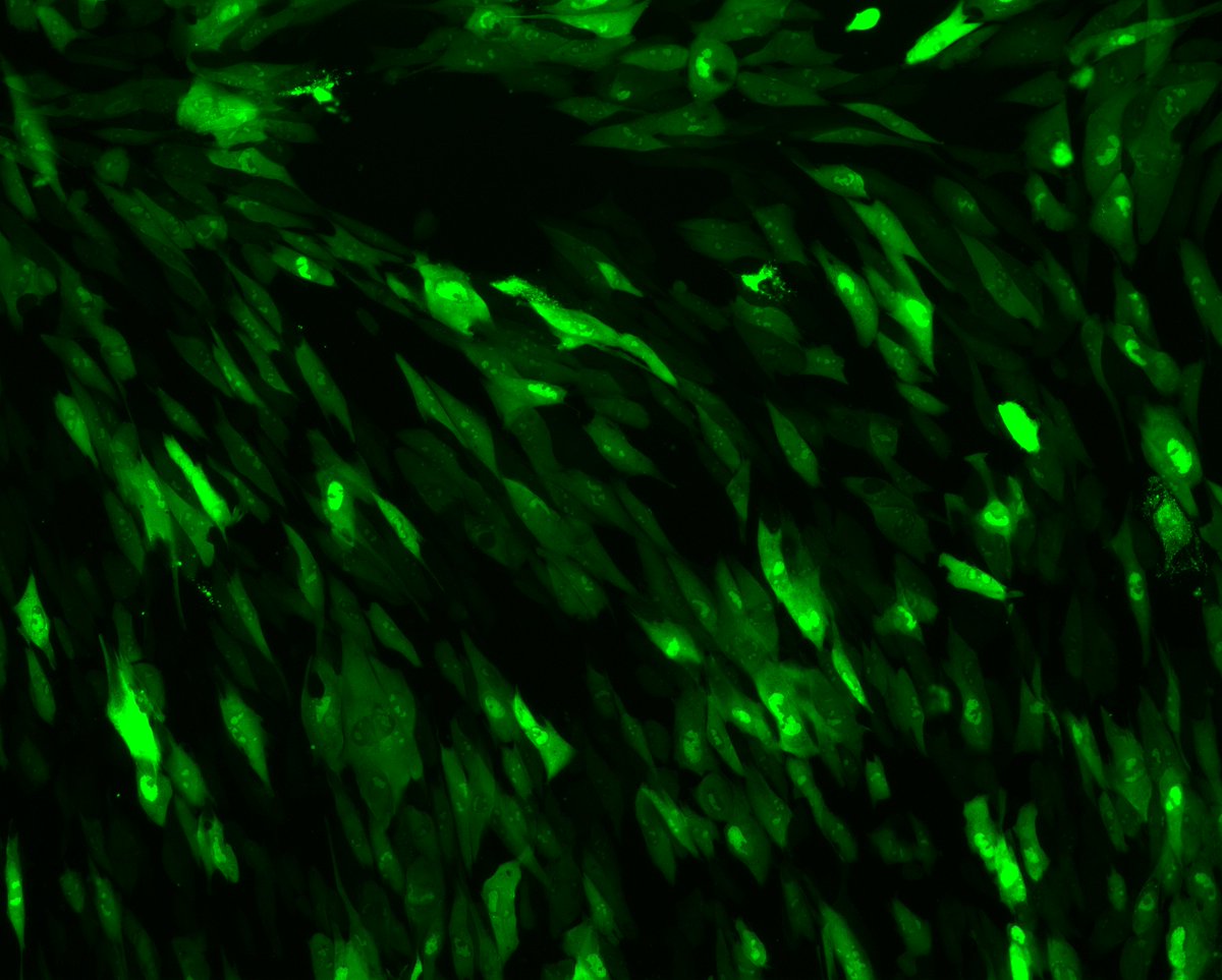 NeoVirTech (@neovirtech) on Twitter photo Picture of the month, November 2022
hCMV ANCHOR strain infecting human primary fibroblast. Want to challenge your product on our autofluorescent virus collection ? Contact us at contact@neovirtech.com Picture of the month, November 2022
hCMV ANCHOR strain infecting human primary fibroblast. Want to challenge your product on our autofluorescent virus collection ? Contact us at contact@neovirtech.com
