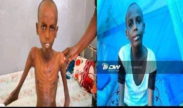 MellathM's tweet photo. #2YearsTigrayGenocideSad💔
#AllowHumanitarianAidToTigray
#EndTigraySiege
#TigrayCannotWaitLonger
#JusticeforTigrayPeople
#MikeHammerUSActionNow
#AntonioGuterresActionNow
The people of tigray still suffering more, no food, no clear water, no medicine supply, no fuel, no bank open https://t.co/scH7iVXpdS