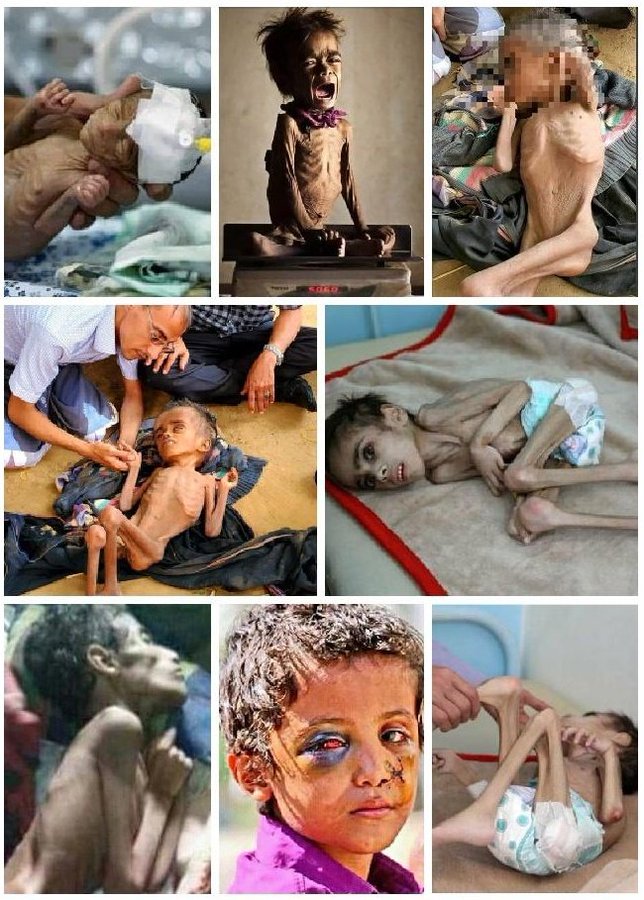 MyMikeJonathan's tweet photo. If you are humans who still have a clean heart, don't you cry when you see these little #Yemeni children ?? 

#YemenCantWait https://t.co/ZZYHZl58pb