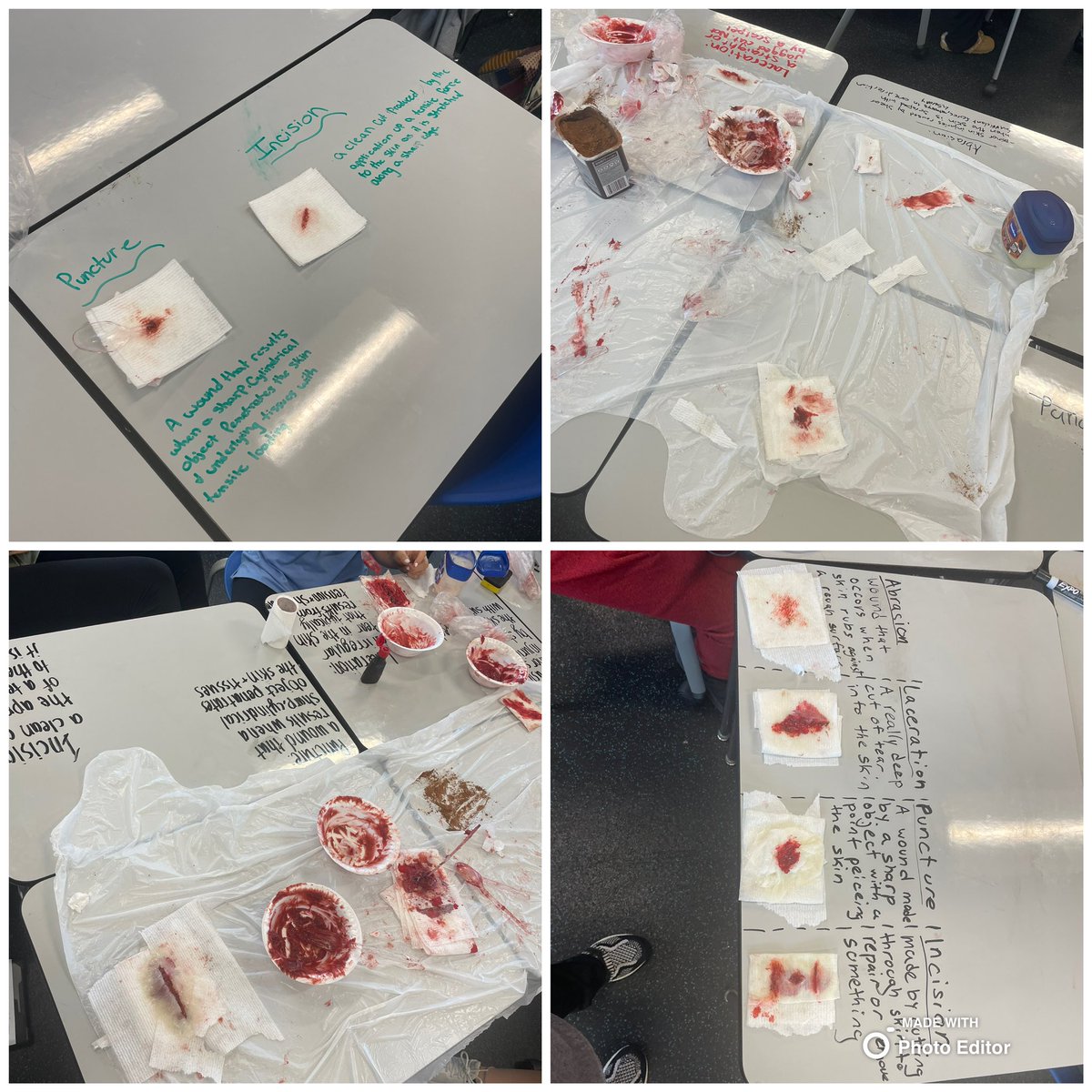 WS_Storm_PE's tweet photo. Students in Community First Aid have been learning all about different soft tissue injuries, how they occur and what they look like. They created some examples of open wounds during our lab today! #firstaid #woundcare #woundlab https://t.co/0nWweWFNLc