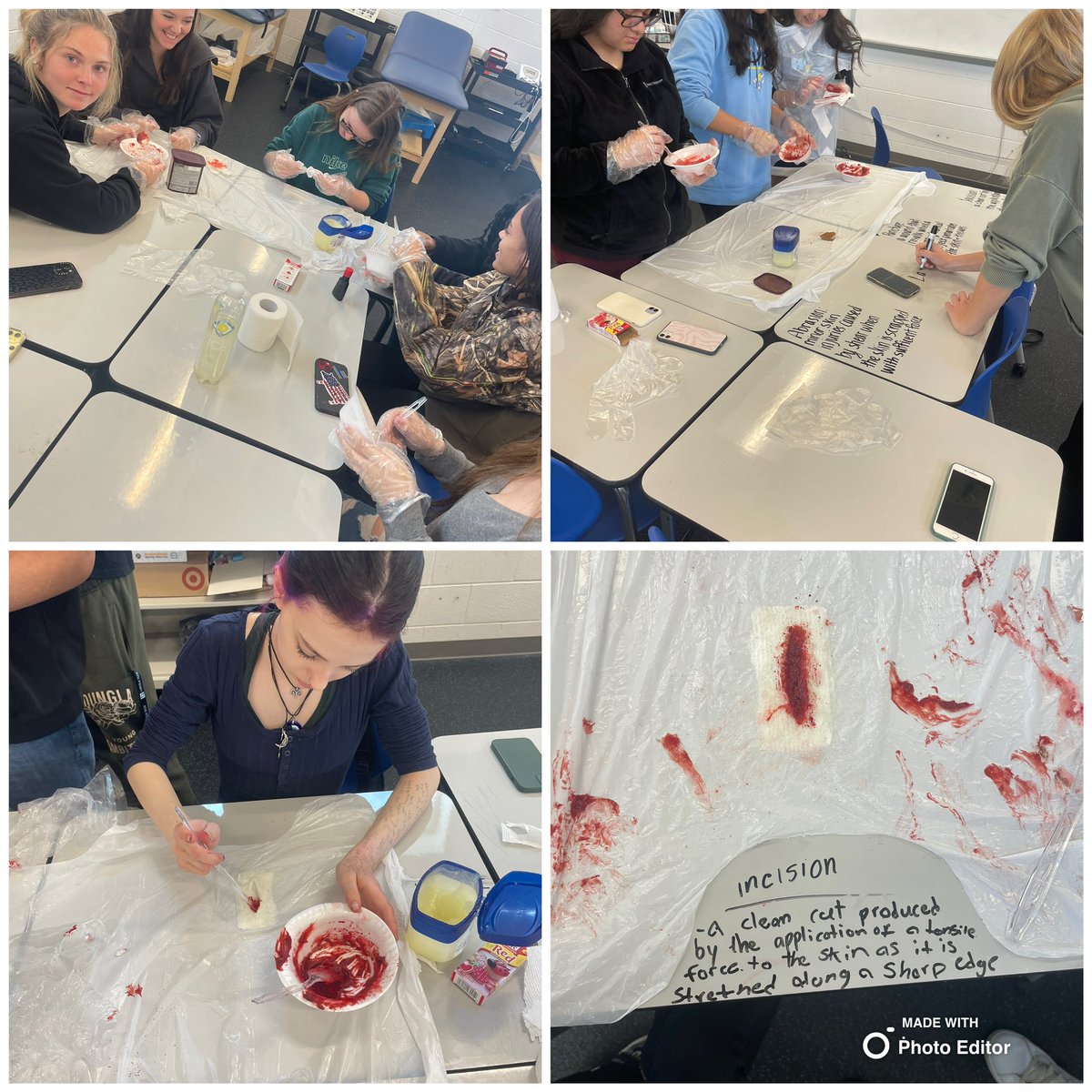 WS_Storm_PE's tweet photo. Students in Community First Aid have been learning all about different soft tissue injuries, how they occur and what they look like. They created some examples of open wounds during our lab today! #firstaid #woundcare #woundlab https://t.co/0nWweWFNLc