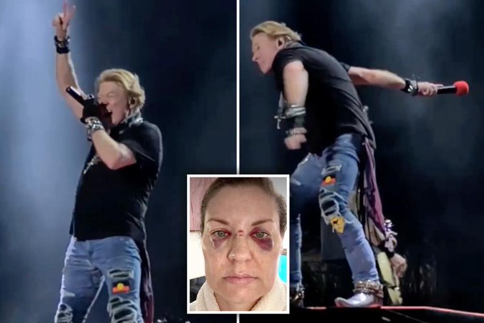 DailyLoud's tweet image. Guns N' Roses fan hit by microphone thrown by Axl Rose at concert