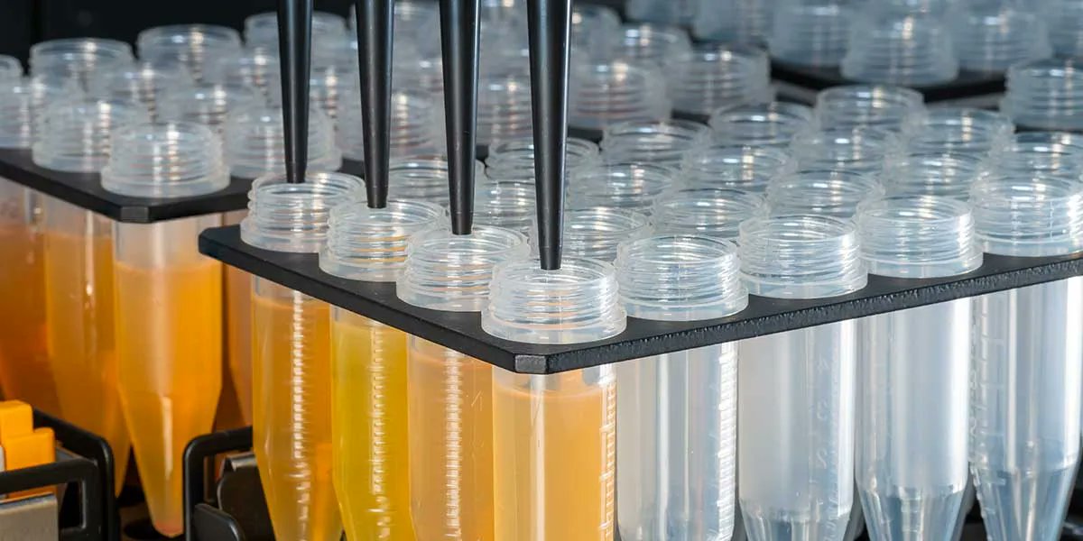 Genetics_LR's tweet image. Check out Tips on Establishing a Reliable Cell Free DNA (cfDNA) Workflow from Plasma Samples to avoid common mistakes and gain new insights. For research use only. Not for use in diagnostic procedures. #cfDNA #plasma #NucleicAcidPurification Link➡️buff.ly/3UsOY5I