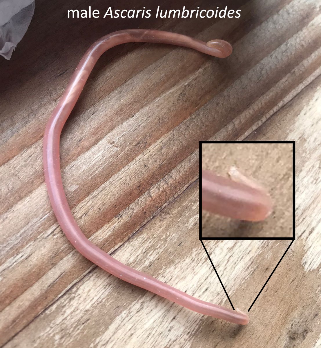 The answer to the Parasite Case 703 is now up: Adult Ascaris lumbricoides – you can tell it’s a male from the curly tail! See the full description here: parasitewonders.blogspot.com/2022/11/answer… #mayopath #pathology #path2path #MayoClinMicro #CrittersOnTwitter #PathBugs