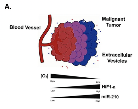 KennethWWitwer's tweet photo. New preprint from Bonita Powell on miR-210-3p in anaplastic and papillary #ThyroidCancer lines and release of the #miRNA in #Argonaute and #ExtracellularVesicles @SciBerg @HDBiolabs @mzeigermd @DominikBuschma1 @OlesiaPhd...pre-@BCMB_JHMI work from Bonita  https://t.co/ZGJnujbisE https://t.co/V3AUFkMCmy