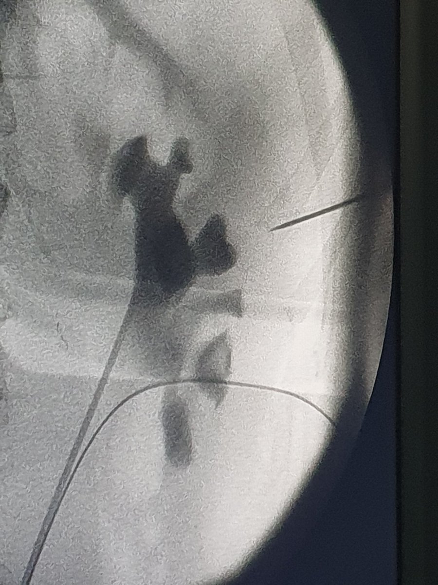 aavanbaelen's tweet photo. @drmarcoscepeda @CoralManso @Leirepmd @eulis_uroweb @ResidentesAEU @InfoAeu @ResidentesCAU Fue un placer para mi. Highly recommended. Muchissimo gracias al team for a perfect and full short course. https://t.co/DYPIVFyXFe