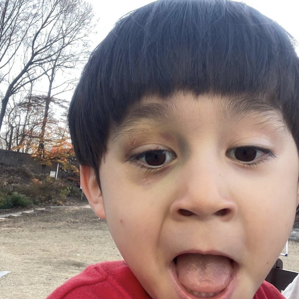 우리 밤탱이 많이 좋아졌어요 ❤️