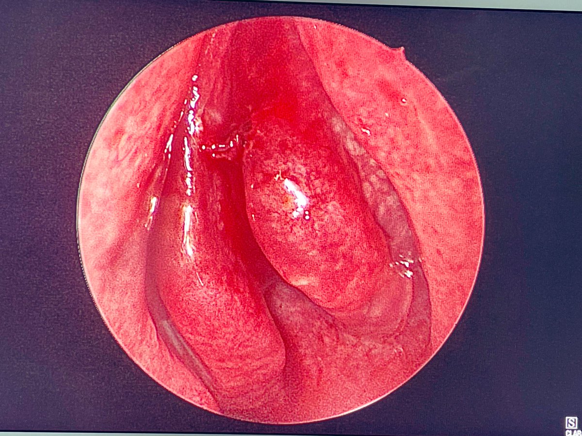 sabiral's tweet photo. Guess the finding ‼️#DNE #ORLHNS #ENT https://t.co/L99g5IJxiK
