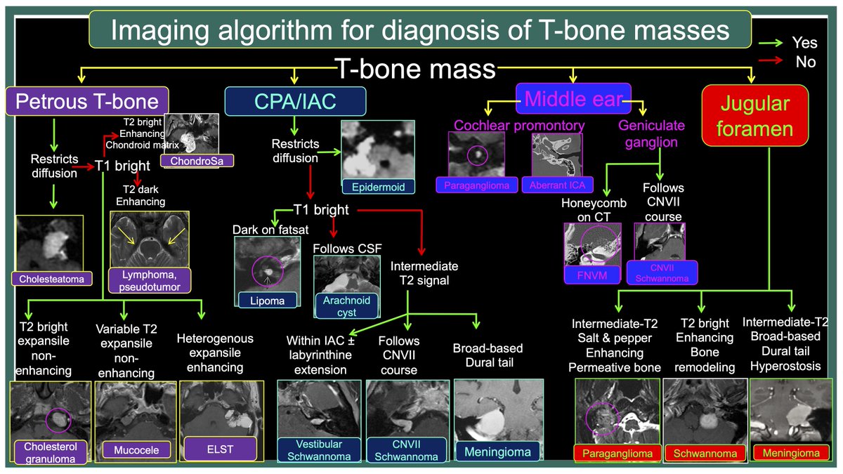 #MCWNeuroradBTW 091Ans:Pseudotumor The imaging appearance is non-specific with lymphoma and IgG4-RD indistinguishable, so FULL POINTS TO EVERYONE WHO SUBMITTED AN ANSWER! Check out #TeachingMoment on Imaging algo for T-bone masses Shouts to @gmoonis 4 the ELST image! #RSNA22