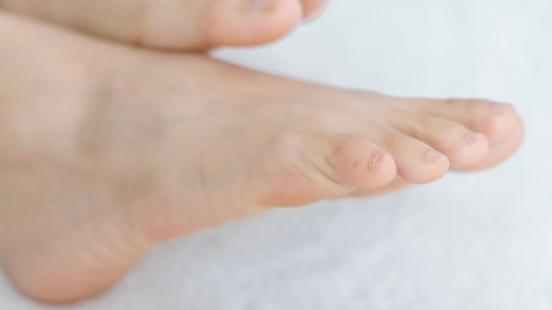 Girls Feet on Twitter "RT mmmm_patas beautifulfeetmodel 