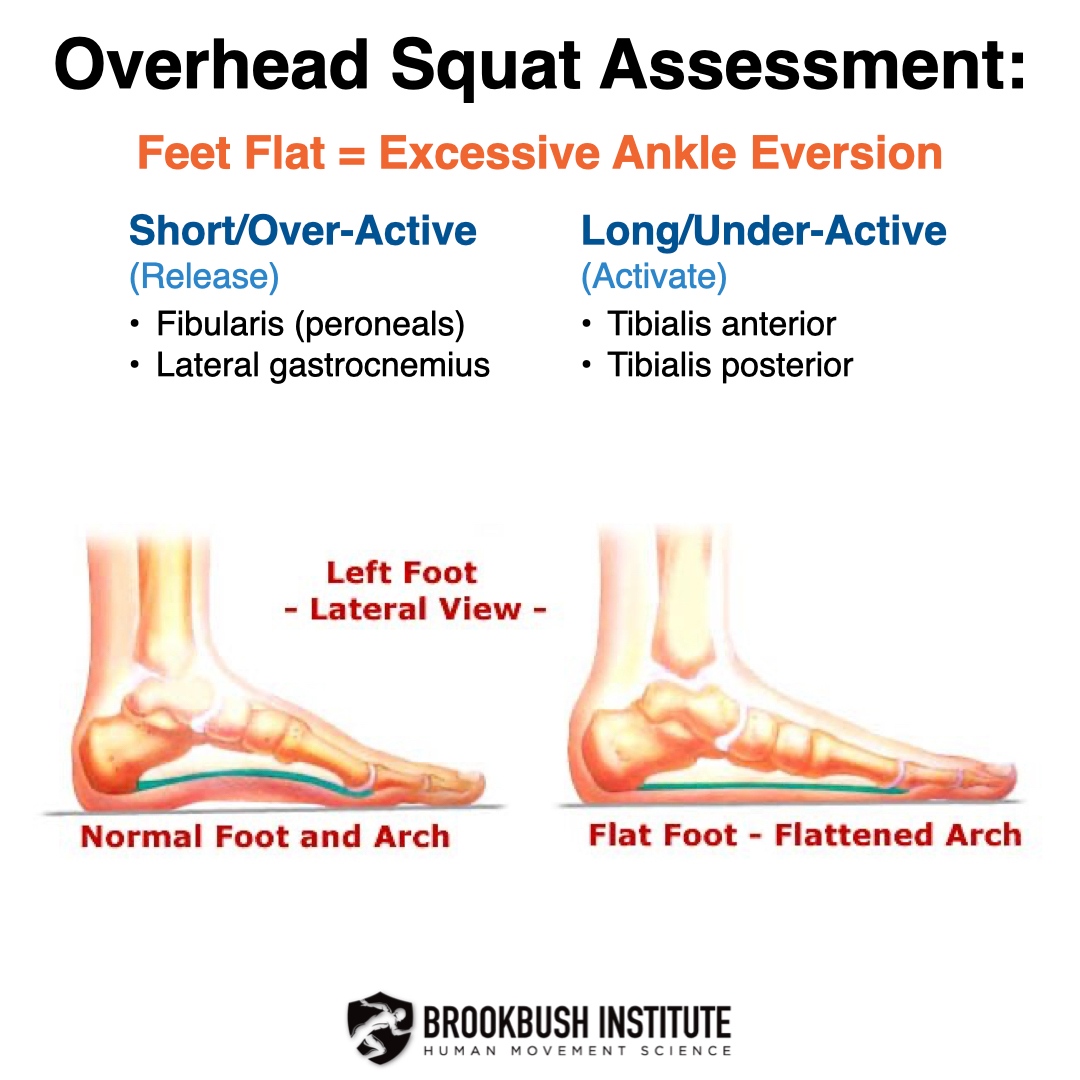 BrookbushInst's tweet photo. 🔴 Overhead Squat Assessment Signs of Dysfunction: Feet Flatten and Feet Turn Out
For more info:
Click on https://t.co/GJlVERJVOD
Choose this image
#brookbushinstitute #overheadsquatassessment #overheadsquat #ohsa #assessment #personaltrainer #flatfeet https://t.co/y7JU1OXlLS