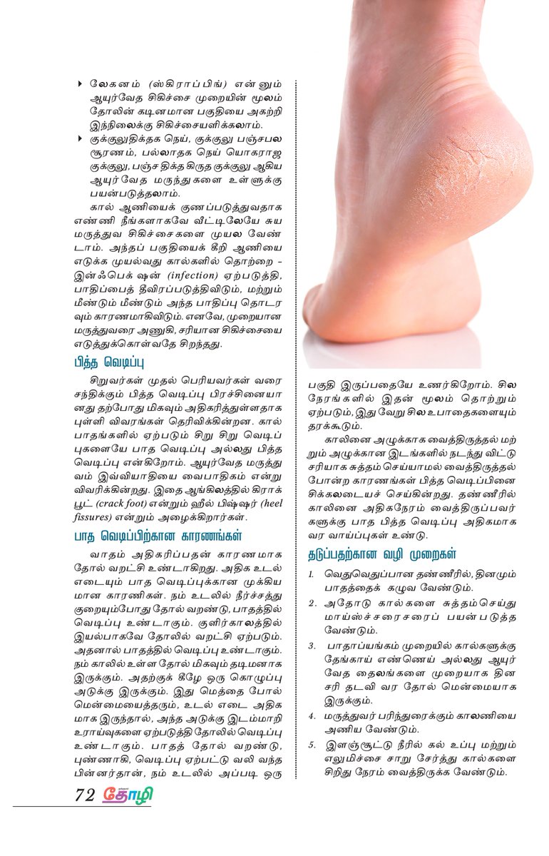 HeritageChennai's tweet photo. To know more about the holistic approach of Foot #Corns &amp; #Calluses Treatment in #Siddha &amp; #Ayurveda; Call +91-7448813242

#callustreatment #pedicure #footcare #feet #diabeticfootcare #toes #callusremover #foothealth #tamilhealthtips #health #healthtips #Kungumam #குங்குமம் https://t.co/ZpiexSB7ia