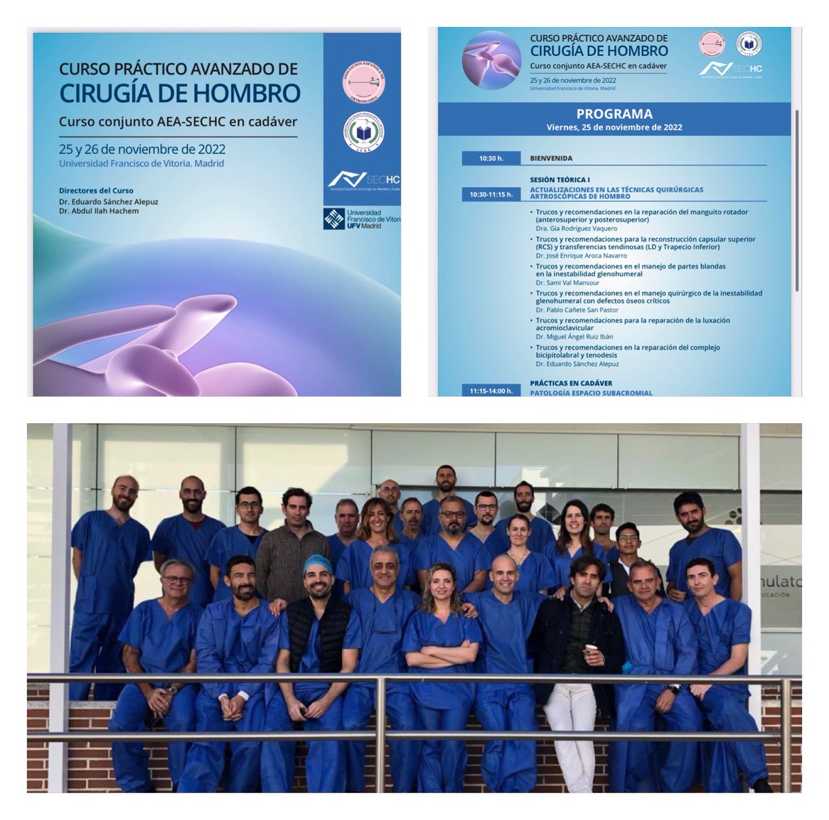 🟣Curso práctico avanzado de Cirugía de Hombro🟣

▪️Curso conjunto <a href="/aeartroscopia/">AEA</a>  <a href="/sechc_oficial/">SECHC</a> en cadáver

▪️25-26 Noviembre

✅Gracias a todos los Alumnos, Profesores y Casas Comerciales por el nivel científico