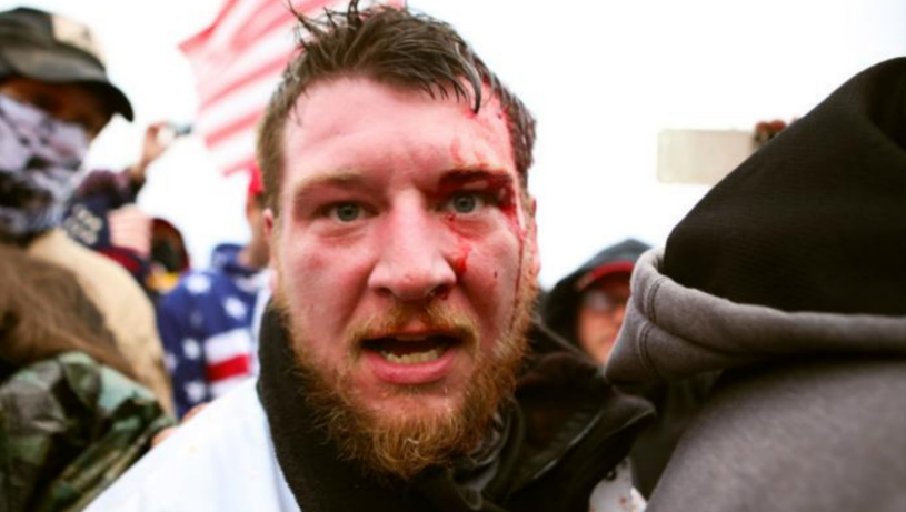 8w8h8y8's tweet photo. @MacFarlaneNews #Insurrectionist #KyleFitzsimons 37, guilty on 11 charges, 7 are felonies.
So far #GuyReffitt 48, convicted on 5 felonies, is serving the longest sentence to date, 7.5y.
Fitzsimons may be the 1st #January6th defendant server over 10y. Hope he gets at least 15y. https://t.co/6huc3rK8pF