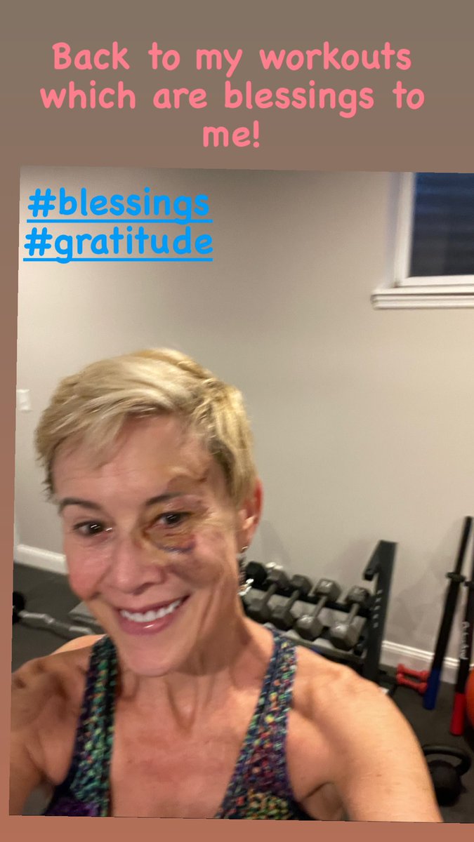 PaulaMaier3's tweet photo. So glad to be able to work out again!
But hey you should see the other guy!! 🤣
#skincancersucks #mohsskincancersurgery https://t.co/Iq37uKZR5H