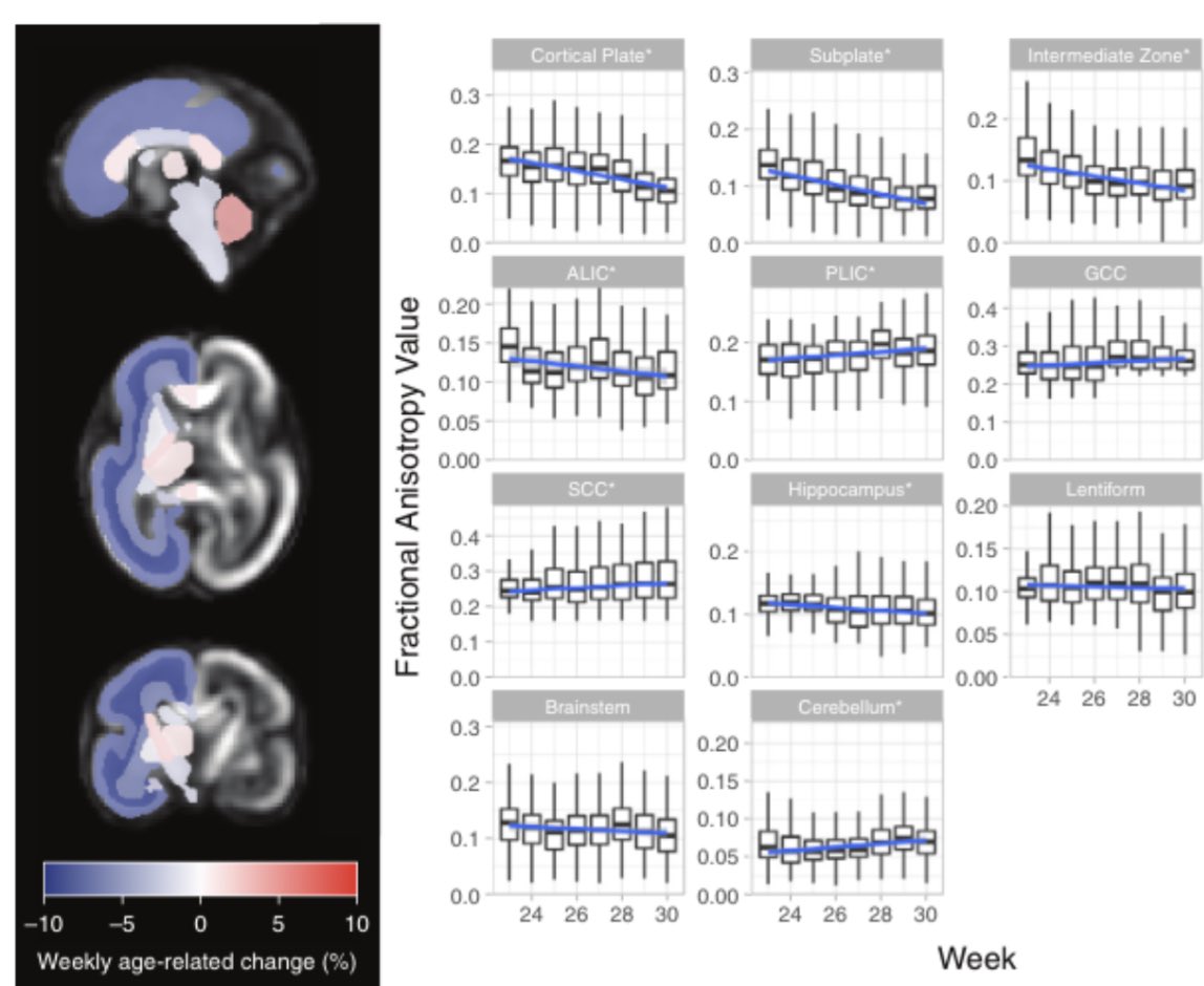 Camilo Jaimes (@camilojaimesc) on Twitter photo Post 🦃 congratulations to the team. We struggled with the analysis we wanted to perform on fetal brain 🧠diffusion. There was only one thing left to do: build new tools ! <a href="/ImagineBCH/">Imagine BCH</a> <a href="/SebGal1230/">Sebastian Gallo, MD</a> <a href="/boschildrensrad/">Boston Children's Radiology</a> <a href="/OnurAfacanMRI/">Onur Afacan</a> <a href="/MGHImaging/">Mass General Imaging</a> <a href="/fmachadorivas/">Fedel Machado Rivas</a> Post 🦃 congratulations to the team. We struggled with the analysis we wanted to perform on fetal brain 🧠diffusion. There was only one thing left to do: build new tools ! <a href="/ImagineBCH/">Imagine BCH</a> <a href="/SebGal1230/">Sebastian Gallo, MD</a> <a href="/boschildrensrad/">Boston Children's Radiology</a> <a href="/OnurAfacanMRI/">Onur Afacan</a> <a href="/MGHImaging/">Mass General Imaging</a> <a href="/fmachadorivas/">Fedel Machado Rivas</a>