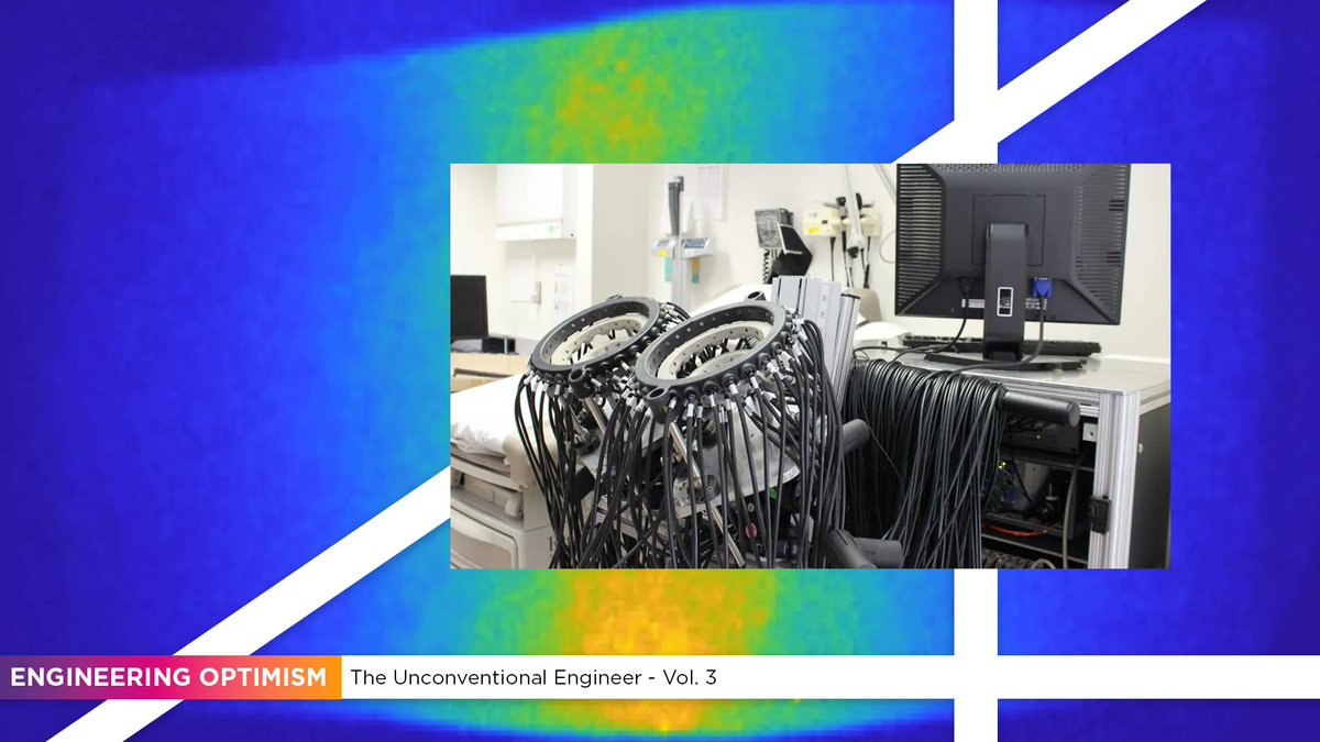 nyutandon's tweet image. #Tandon #biomedicalengineering department chair Andreas H. Hielscher and researcher Alessandro Marone have partnered to use #frequencydomain #opticalimaging to diagnose and track #lupusarthritis. #NYUTandonMade 
bit.ly/39QKTmK