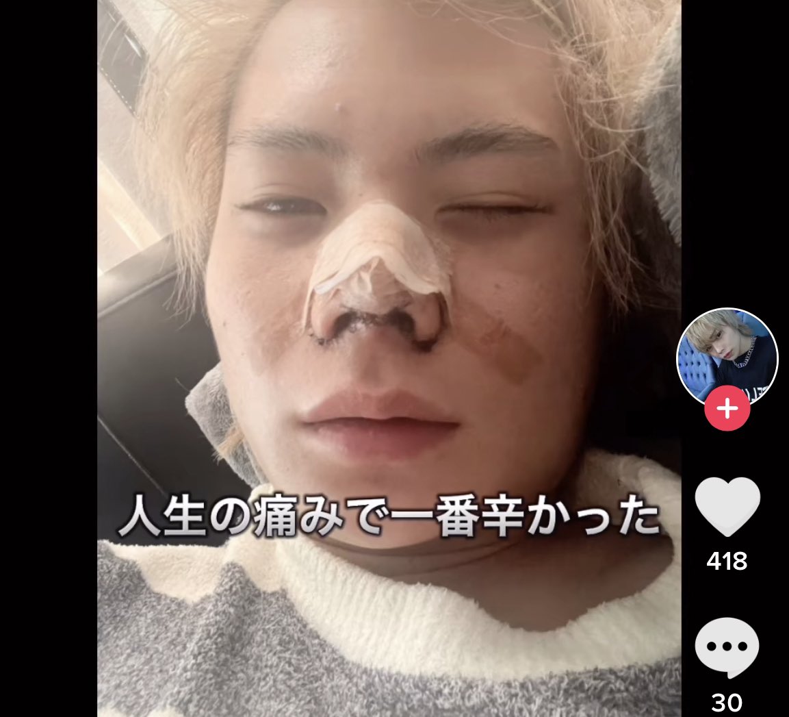 _am1chan's tweet photo. 感染拘縮かと思ったけどギプスの時点で形…。某ビューティークリニックかな。 https://t.co/zekmkWgEX5