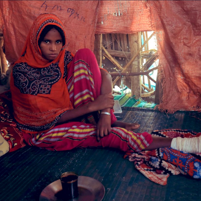 khaj_nat's tweet photo. An Afar woman sits in her house after sustaining injuries on her right leg from an explosive in the aftermath of the fight between ENDF and TPLF forces in Kasagita, Afar, Ethiopia…⚔️🇪🇹😔
(Image: Reuters)… https://t.co/J7m819PSo6