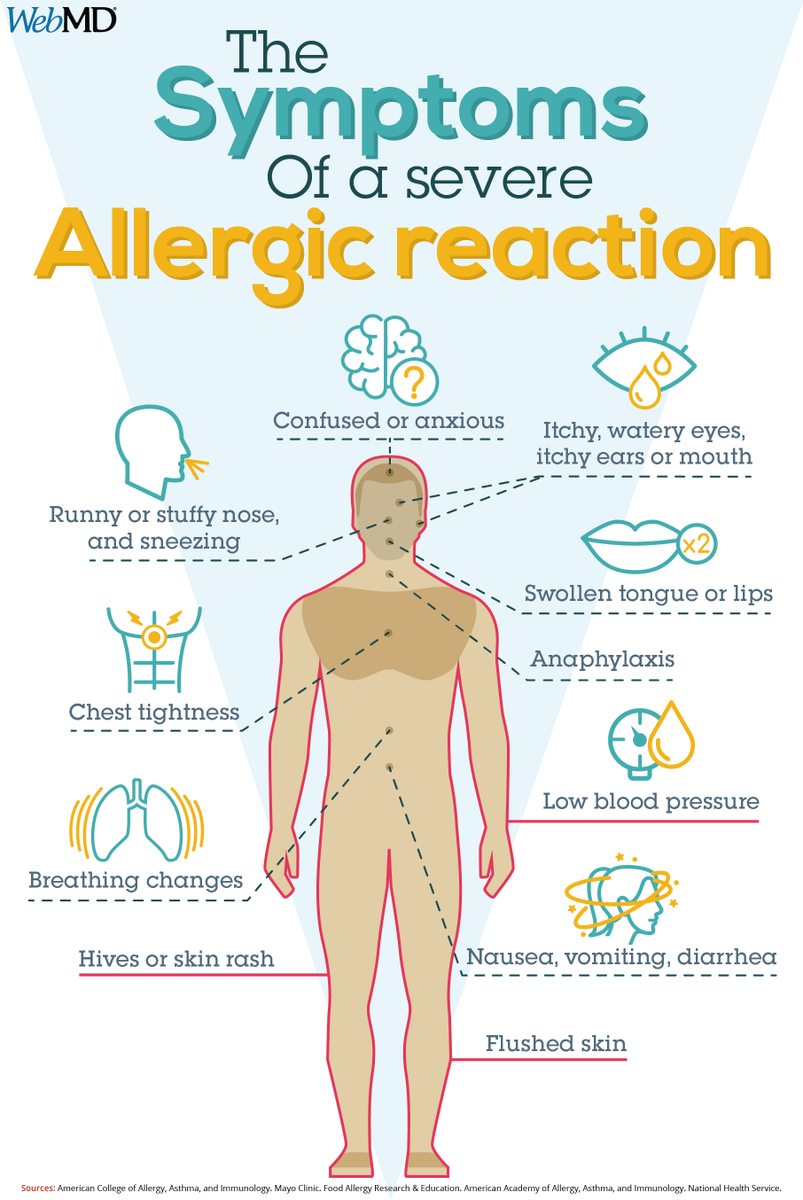 WebMD's tweet image. Learn how to tell if you or someone near you is having a severe allergic reaction. wb.md/3AxBMFi