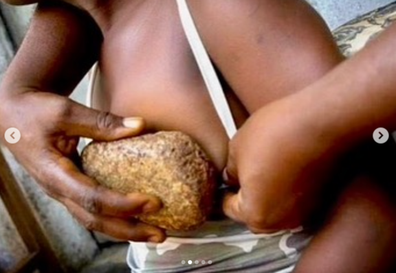 BintouMariamT's tweet photo. Le #RepassageDesSeins consiste à  repasser, masser ou marteler à l'aide d'objets durs ou chauffés les seins des adolescentes afin que les seins disparaissent pour les rendre moins attirantes pour les hommes. Cela favorise le cancer du sein #MGF. https://t.co/G71EePMZDs 
#16Jours https://t.co/nMPl6X2I28