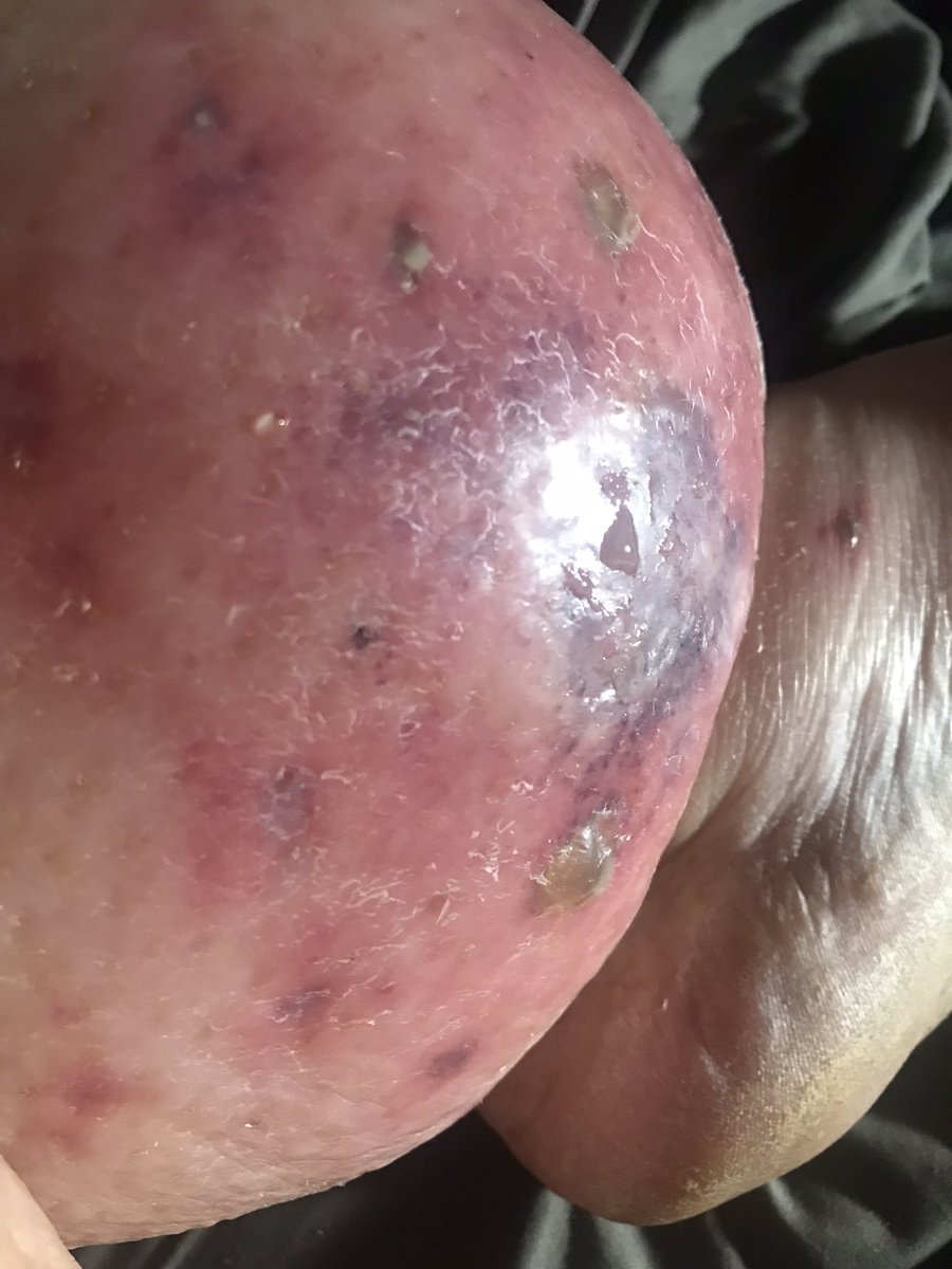 I’m in pain send slushy