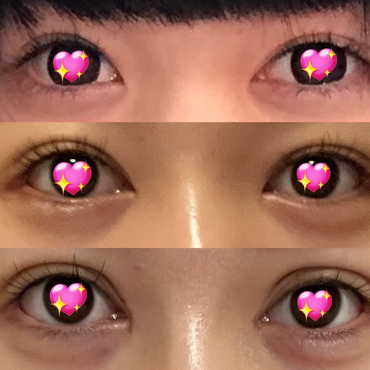 deroderousoku's tweet image. 16歳から20歳(今)までの目の変化。まだDTだけど。鼻目輪郭と、目立つところからやったから、整形してるって実感が湧いて嬉しかったけど、もっと順番とか考えるべきだったと今なら思う