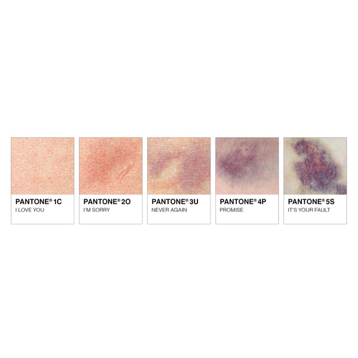 Le Pantone des violences conjugales

Par Leina Fleury (bit.ly/3GJHOqs)