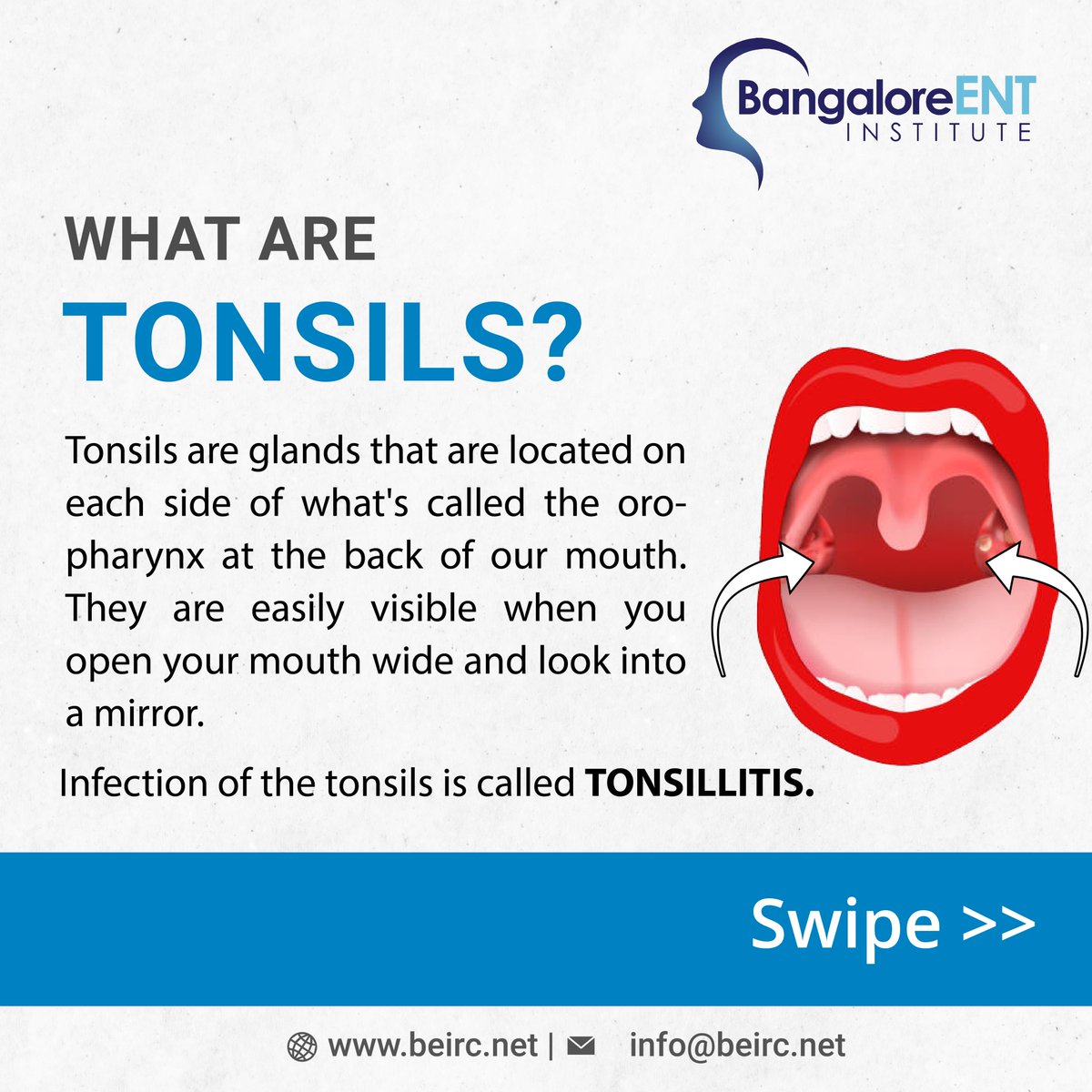 beirc_'s tweet photo. Know Your Tonsils! 
#tonsils #tonsillectomy #bangaloreentinstitute #bangaloreentinstituteandresearchcenter #beirc #bangalore #entconsultant https://t.co/A4QDvTi2zn