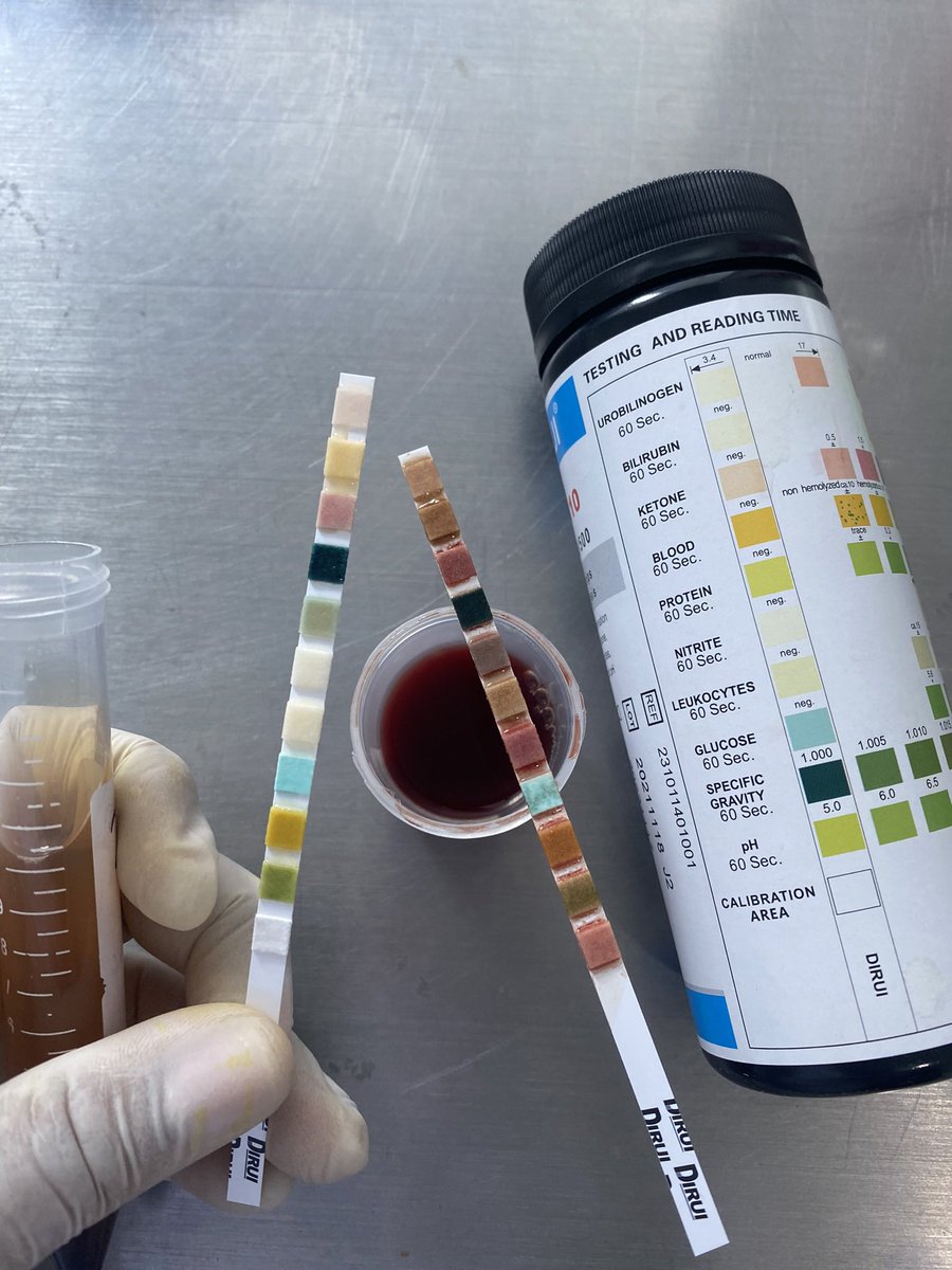 mundomicro2's tweet photo. Hematuria #labclinico https://t.co/BUwCpZgtAH