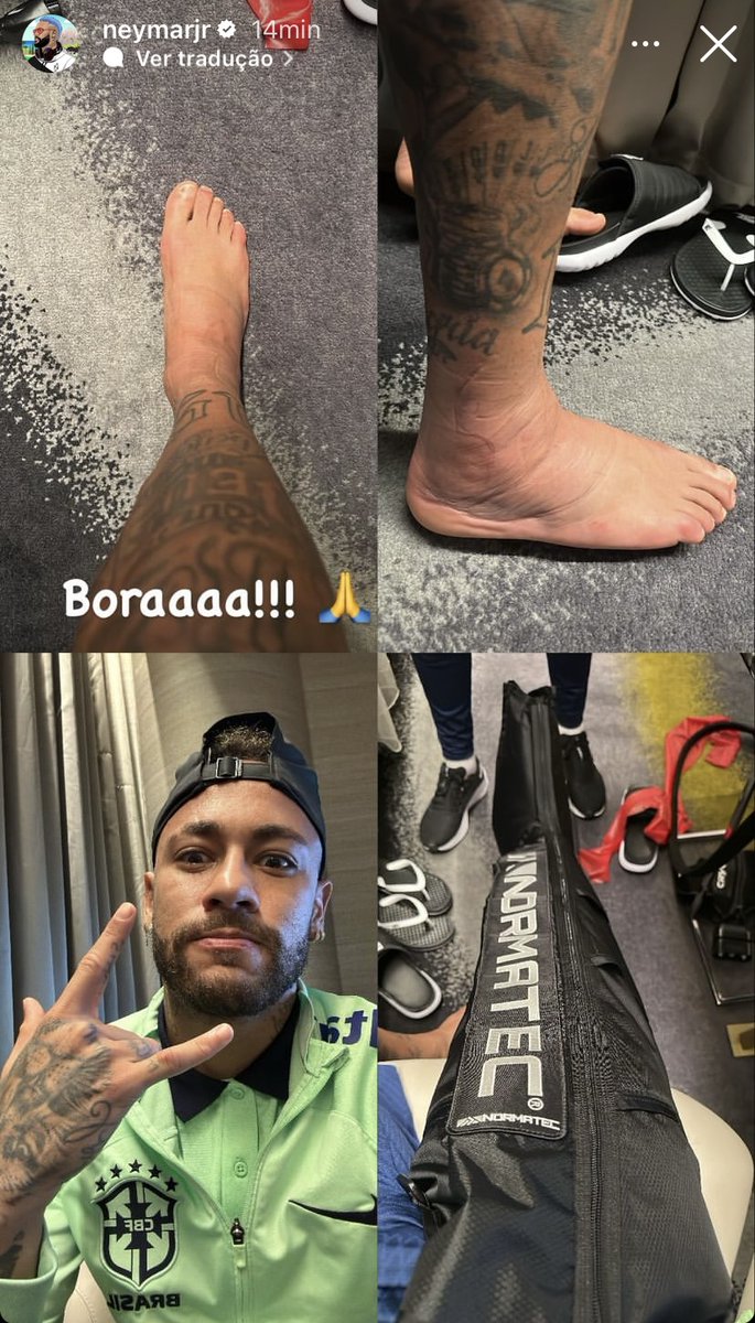 vaidesmaiar's tweet photo. O Neymar postou essa foto do tornozelo dele, algum ortopedista de plantão para dizer se tá melhorando?  #BRA #Qatar2022 https://t.co/hmo4EcpLCe