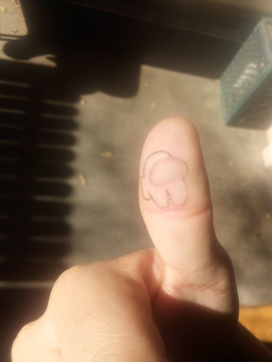 SpamanthS's tweet photo. I burnt my thumb last night and it looks sus https://t.co/N71kAYAN13