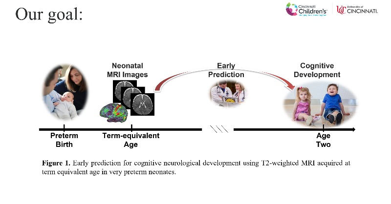 The goal of this project is to develop an early prediction mode for cognitive development based on neonatal MRI #RSNA22