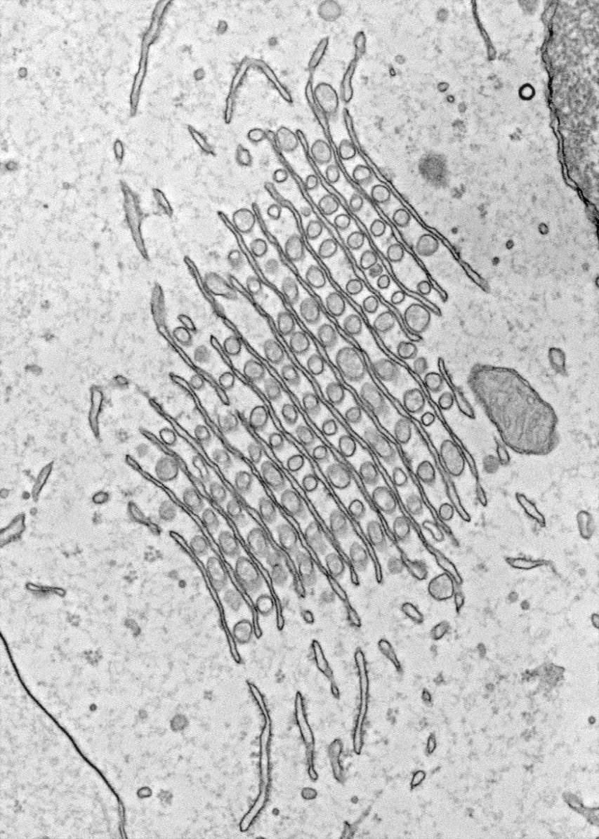 Interesting pattern of the ER in a supporting cell (inner border cell) from a mouse cochlea, with intercalated stacks of tubules.
