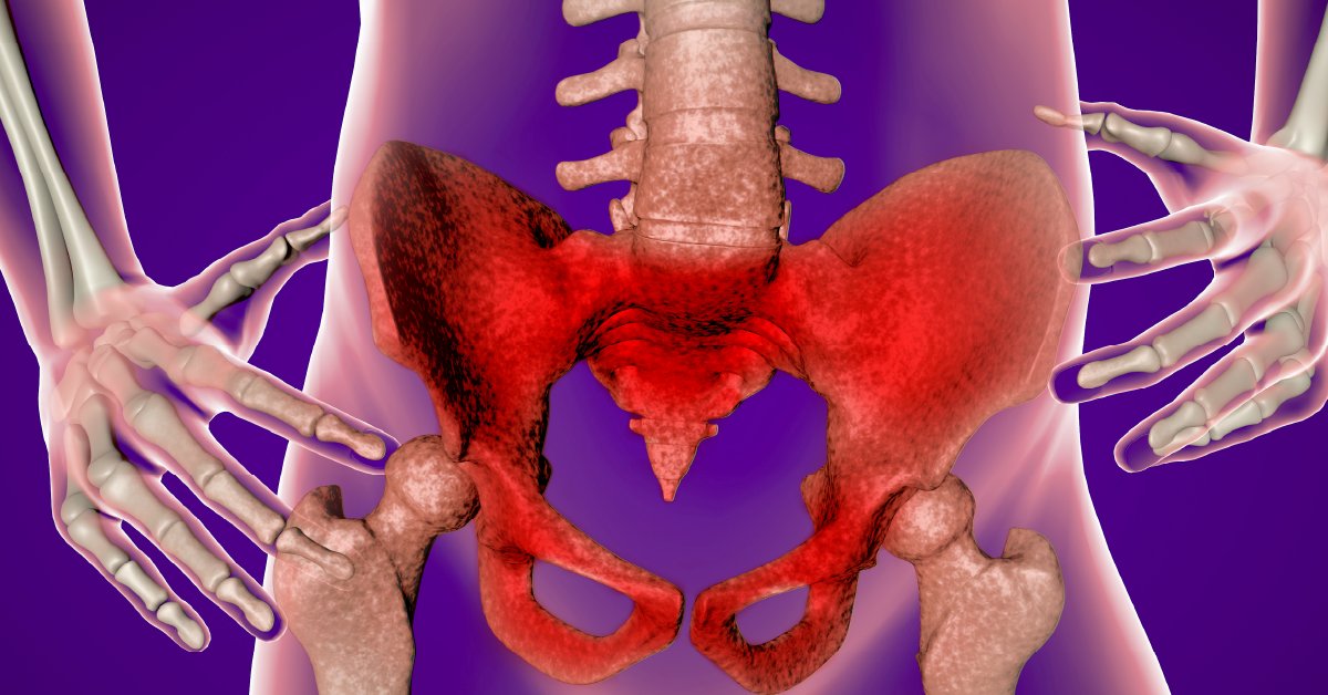 WebMD's tweet image. You use them to sit, stand, dance, kick, and run. Find out what makes your hips hurt, and what you can do about it. wb.md/3XqZCwA