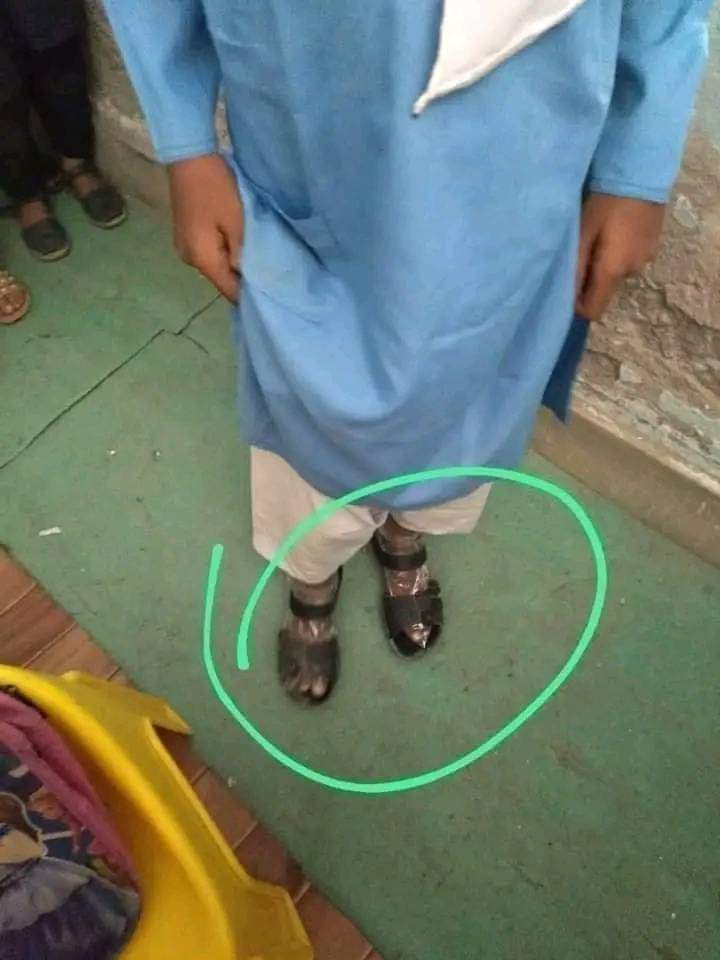 MirMirbhayo's tweet photo. #publicMsg
#copied
آج گورنمنٹ سکول کی بچی کی ایک تصویر سامنے آئی جس نے دل چیر سا دیا
ٹیچر نے کہا سردیاں آگئی ہیں جرابیں لازمی پہن کر آئیں نہیں تو سزا ملے گی
ایک غریب بچی جرابیں ناں خرید سکی شاپر پاؤں پر باندھ کر آگئی
1/2 continue https://t.co/JTo9Dr0hUS