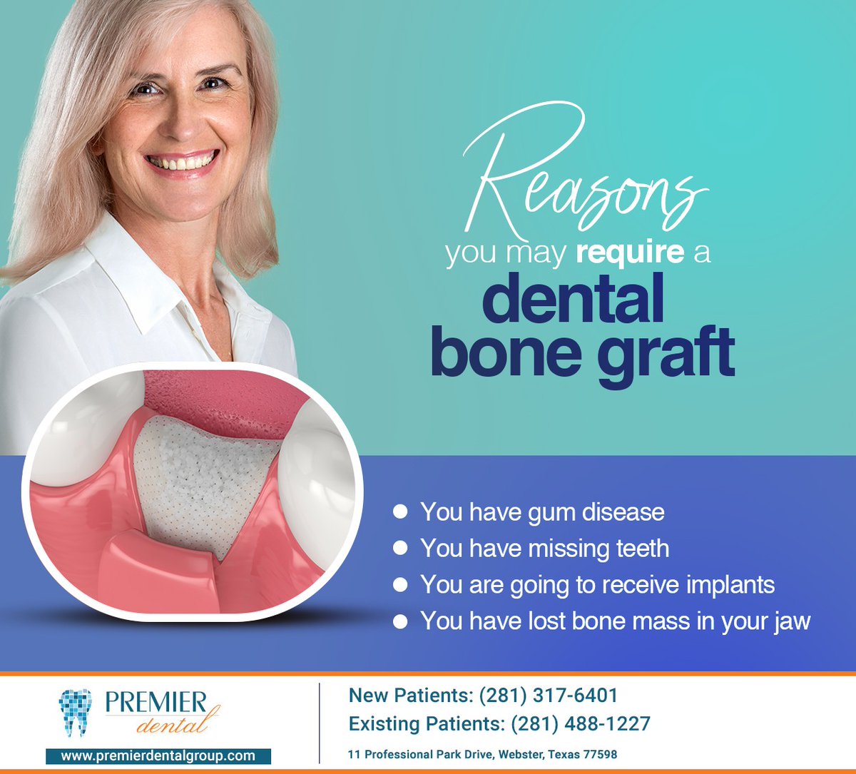 PremierDentalCL's tweet photo. If you experience any of the reasons listed, you would be a good candidate for a dental bone graft. Learn more about this procedure at https://t.co/ypGfb0xQMz or call us at (281) 317-6401 if you have any questions. #premierdental #mauriciorodriguezdds #webster #TX https://t.co/pMVfEfhbJE