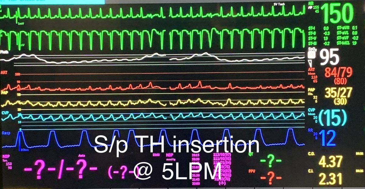 Sandeep M Patel, M.D. tweet media