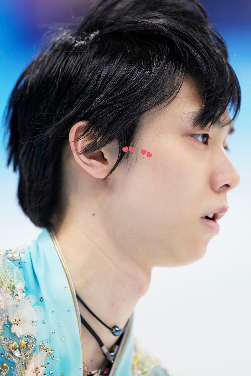  On Twitter ckyuzu And He Has Even More Tiny Under His Eye Another Next To Nose Tiniest 