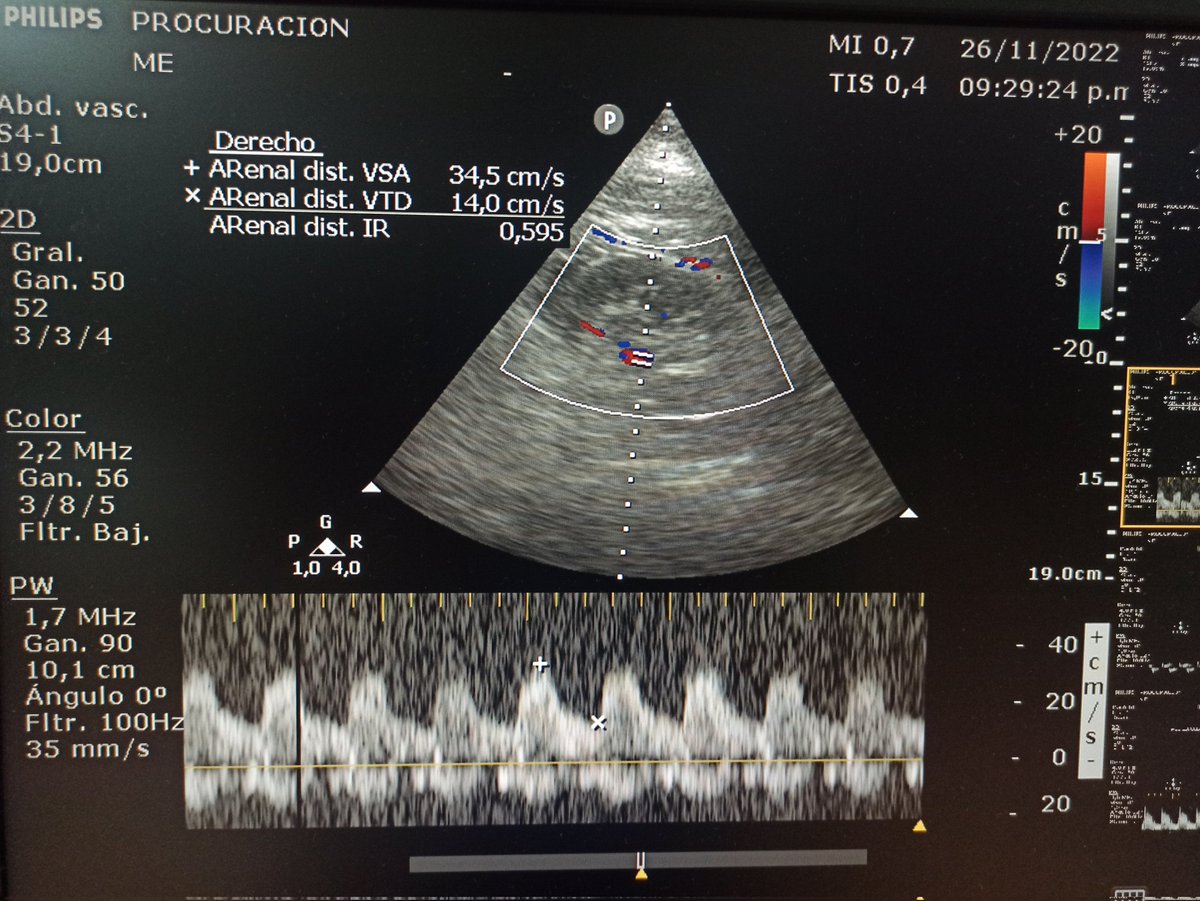 Matías Brizuela tweet media