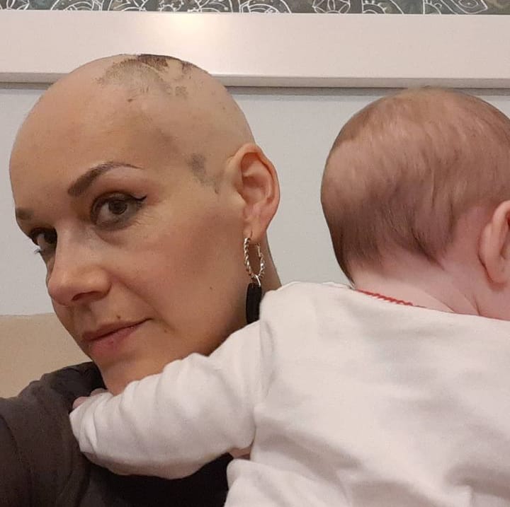 alopeciamujer's tweet photo. #UE 
#Lascalvasexistimos

Por un mundo divers@
https://t.co/aHSU9uU1YN https://t.co/n389hD9fVv