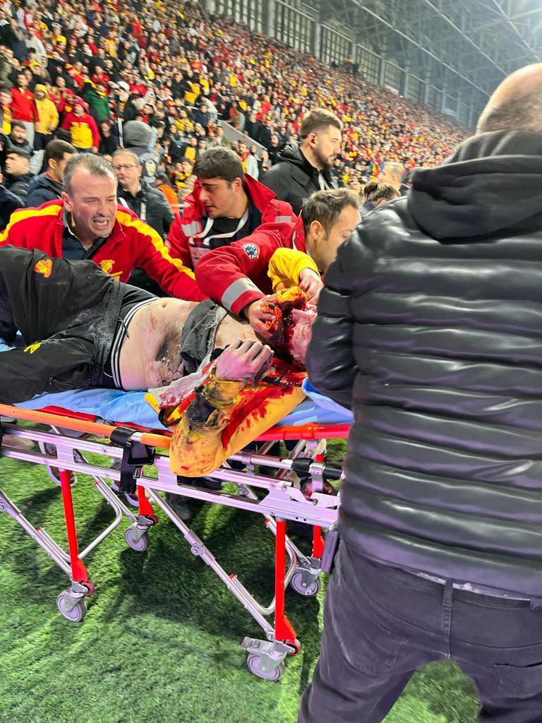 Bunu da göstersene!
#Göztepe