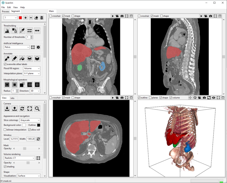ScanXm's tweet photo. ScanXm is now available for download!

ScanXm is a Windows application for the visualization, annotation and segmentation of biomedical images.
- no python scripting
- no cloud computing
- no need for an expensive GPU
Just download at https://t.co/r73CwdrULz, install and run! https://t.co/YVyTqG3MLq
