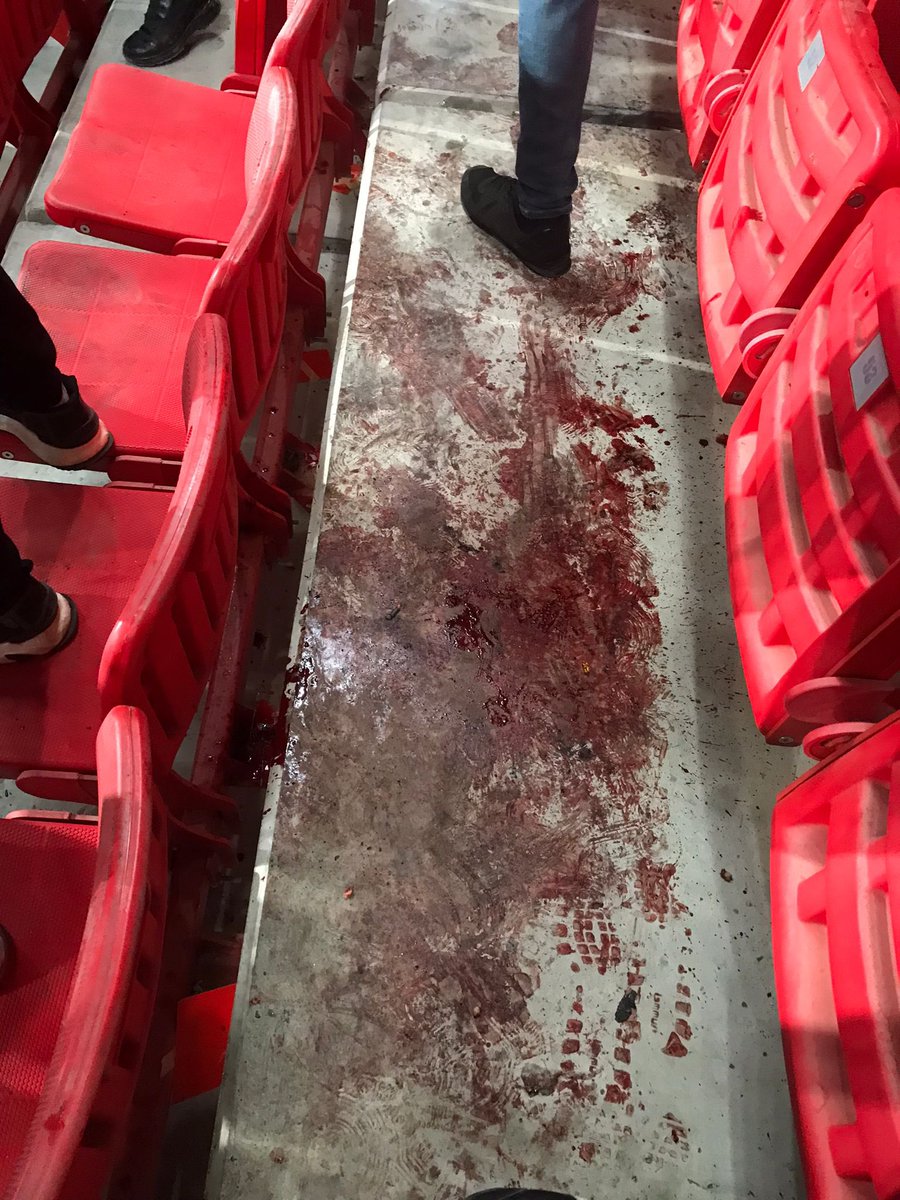 Olayları tek taraflı yansıtıp sadece Göztepe taraftarını suçlayanlar bu fotoğraflara iyi baksın. 
Olaylar altay tribününden alçakça atılan bir işaret fişeği ile bir taraftarımızın yüzünde ağır şekilde yaralanması ile başladı.