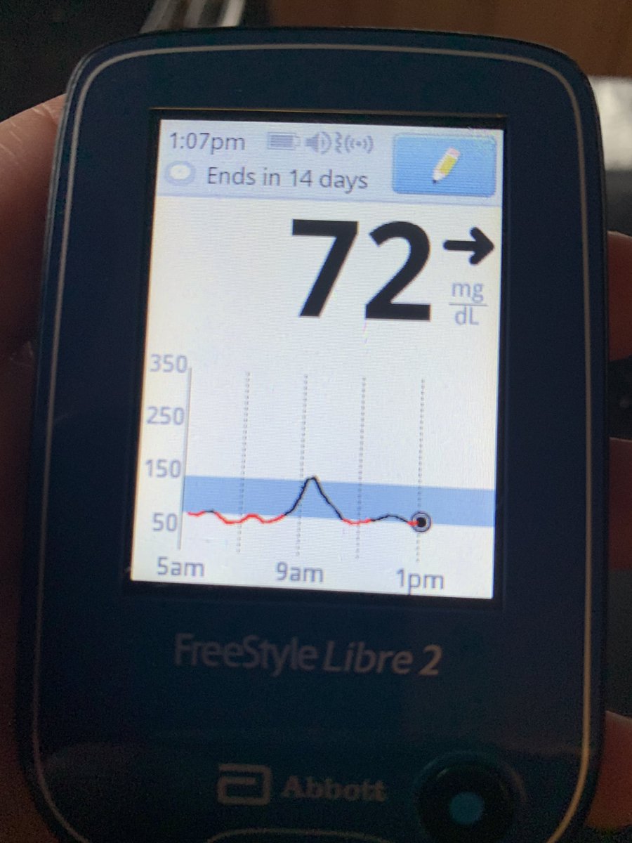 OrenCNN's tweet photo. Day going very well for #myBS (though a bit too low). #diabetes #DiabetesAwarenessMonth #type1diabetes https://t.co/jKjQOjiB7k
