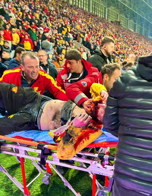 Eğer kaleciye yapılan hareket olmasaydı TV ekranlarında asla göremeyecektiniz, maç da kaldığı yerden devam edecekti.
#Göztepe