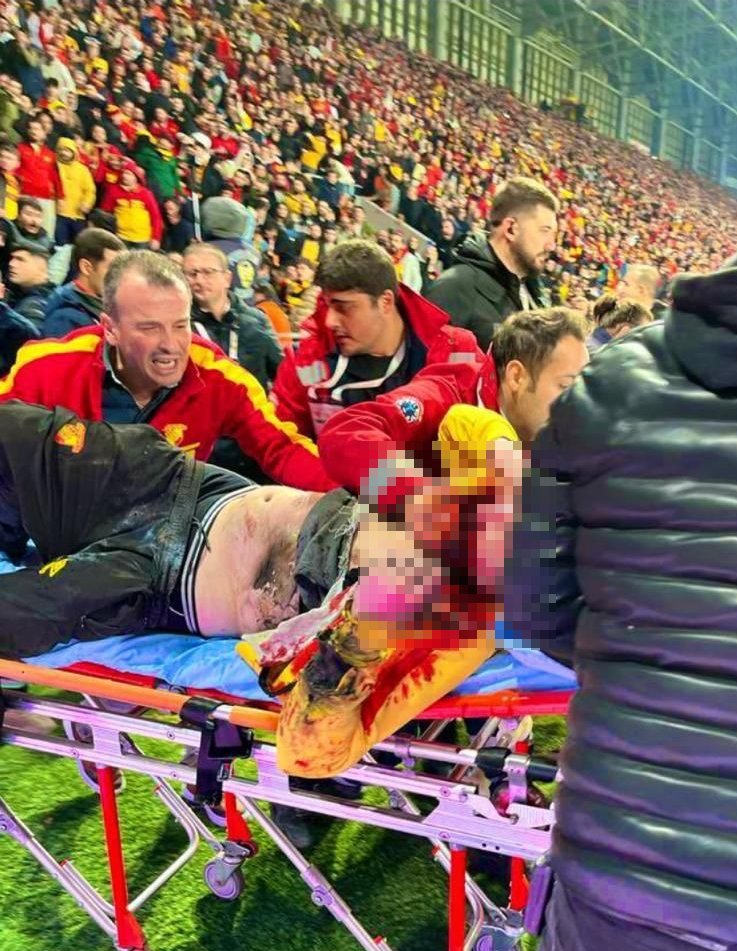 tribundergi's tweet photo. #İzmirDerbisi'nde #Altay tribününden #Göztepe tribününe atılan bir işaret fişeği, bir Göztepe taraftarının ağır yaralanmasına neden oldu.

▪️ Çok geçmiş olsun. https://t.co/L9dOIqDHik